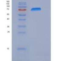 人PARP-3 / PARP3重组蛋白His & GST tag