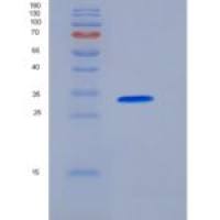 人Carbonic Anhydrase VII / CA7重组蛋白His tag