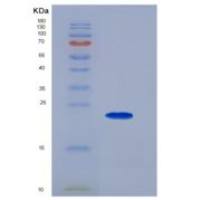 人NRAS重组蛋白His tag