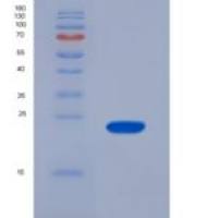 人半胱氨酸甘氨酸丰富蛋白1(CSRP1)重组蛋白