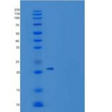 小鼠乙二醛酶Ⅰ(GLO1)重组蛋白His tag