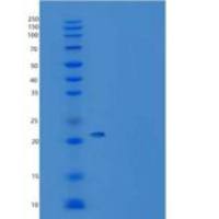 小鼠乙二醛酶Ⅰ(GLO1)重组蛋白His tag