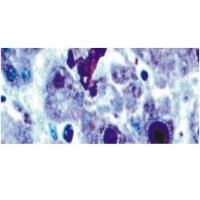 鼠抗人腺病毒单克隆抗体