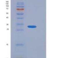 人ACBD6重组蛋白His tag