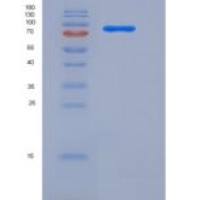 人AKT3重组蛋白GST tag