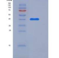 小鼠CLEC14A / EGFR-5重组蛋白His tag