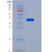 小鼠IL6RA / CD126重组蛋白His tag