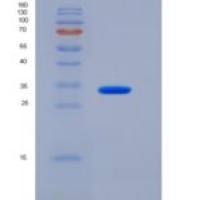 人IMP1 / IMPA1重组蛋白His tag