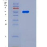 大鼠PNLIPRP1 / PLRP1重组蛋白His Tag