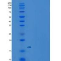 人细胞维甲酸结合蛋白2(CRABP2)重组蛋白His tag