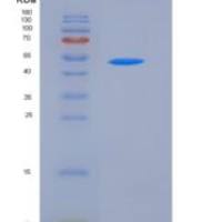 小鼠犬尿氨酸酶(KYNU)重组蛋白His tag