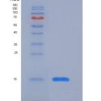 人血清淀粉样P物质(SAP)重组蛋白His Tag