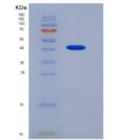 人TAPBP/ Tapasin重组蛋白His Tag