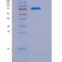 小鼠MFI2 / CD228 /黑转铁蛋白重组蛋白His tag