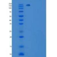 人ITGA6和ITGB1异二聚体重组蛋白