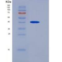 人神经降压素(Neurotensin)重组蛋白Fc tag