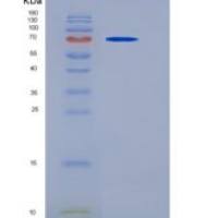 人PRMT5 / SKB1重组蛋白His & FLAG tag