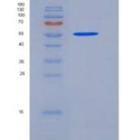 人非组织特异性碱性磷酸酶(ALPL)重组蛋白His tag