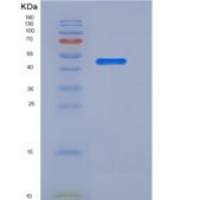 大鼠Angiotensinogen / SerpinA8 / AGT重组蛋白His Tag