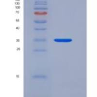 人ANXA5 / Annexin Ⅴ / Annexin A5重组蛋白