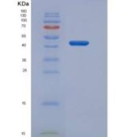 人Gastric lipase / LIPF重组蛋白His tag