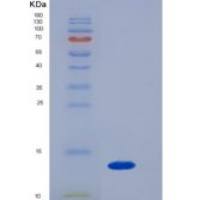小鼠β2-微球蛋白(b2M)重组蛋白His tag
