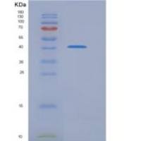 人ITCH / AIP4重组蛋白aa 526-903