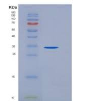小鼠SPINK4重组蛋白Fc tag