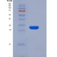 大鼠糜蛋白酶原B1(CTRB1)重组蛋白His Tag