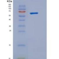 人XRP2 / RP2重组蛋白GST tag