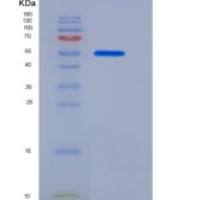 人磷脂转运蛋白(PLTP)重组蛋白His tag