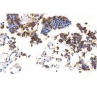 兔抗人促肾上腺皮质激素多克隆抗体