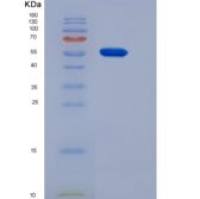 小鼠肌肽酶1(CNDP1)重组蛋白His tag