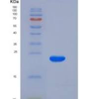 人K-Ras / K-Ras重组蛋白His tag