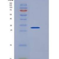 人抗增殖细胞核抗原(PCNA)重组蛋白His tag