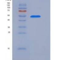小鼠凝血因子IX / FIX / F9重组蛋白His tag