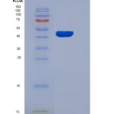 大鼠软骨凝集蛋白(CHODL)重组蛋白Fc tag