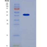 小鼠SerpinB8/ CAP2重组蛋白His tag