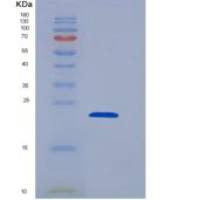 人蛋白磷酸酶3调节因子亚基1(PPP3R1)重组蛋白His tag