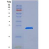 大鼠PRL2A1 / Prolactin-2A1重组蛋白His Tag