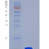 人COL6A3 / Collagen-VI重组蛋白His tag