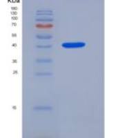 小鼠前列腺酸性磷酸酶/ ACPP重组蛋白His tag