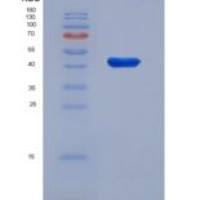 人多萜醇二磷酸寡糖蛋白环糊精糖基转移酶(DDOST)重组蛋白