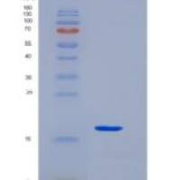 人KCT2 / C5orf15重组蛋白His tag