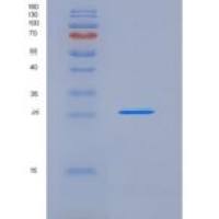 小鼠FLRG / Fstl3重组蛋白His tag