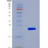 人基质金属蛋白酶12(MMP12)重组蛋白