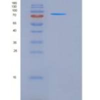 小鼠CAMK4 / CaMKIV重组蛋白His & GST tag