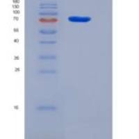 人PRC1重组蛋白His tag