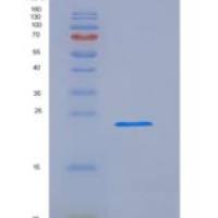 人FK506结合蛋白7(FKBP7)重组蛋白His Tag