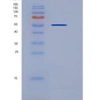 大鼠CD79B / B29重组蛋白His tag